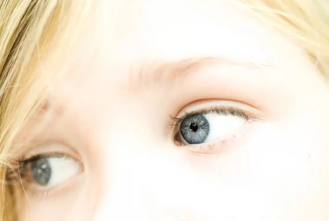blue eyes